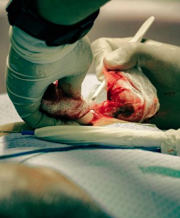 Surgical-Operation (1)